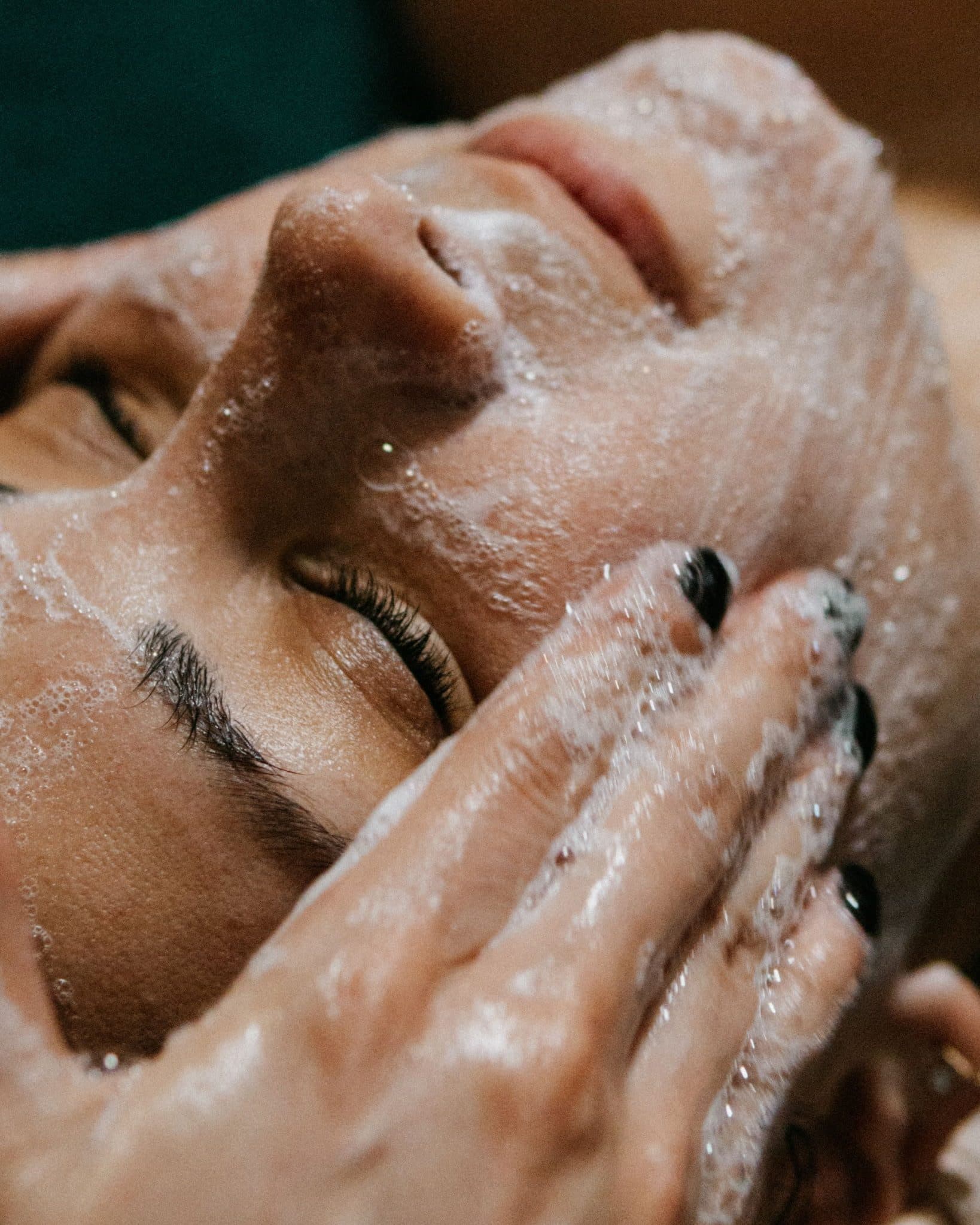 Acne Bootcamp